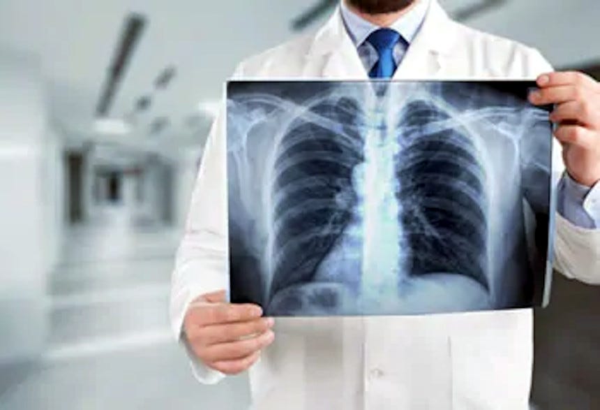 Algoritmo PACE ad alta risoluzione la diagnosi con i raggi X