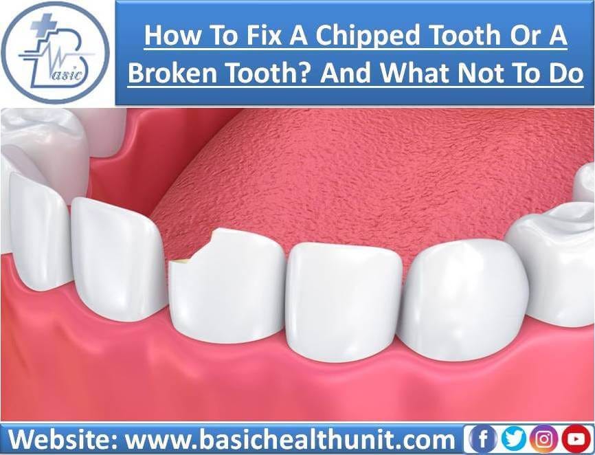 How To Fix A Chipped Tooth Or Broken Tooth? And What Not To Do by