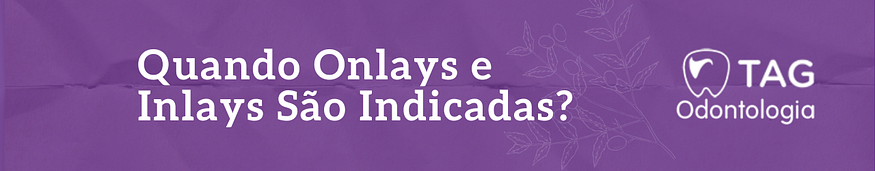 Quando Onlays e Inlays São Indicadas?