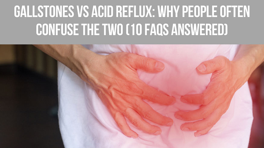 Gallstones vs Acid Reflux: Why People Often Confuse the Two (10 FAQs Answered)