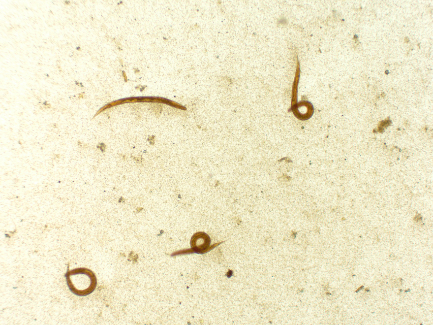 Comprehensive Guide to the Ova and Parasite Test (Stool Test) | by