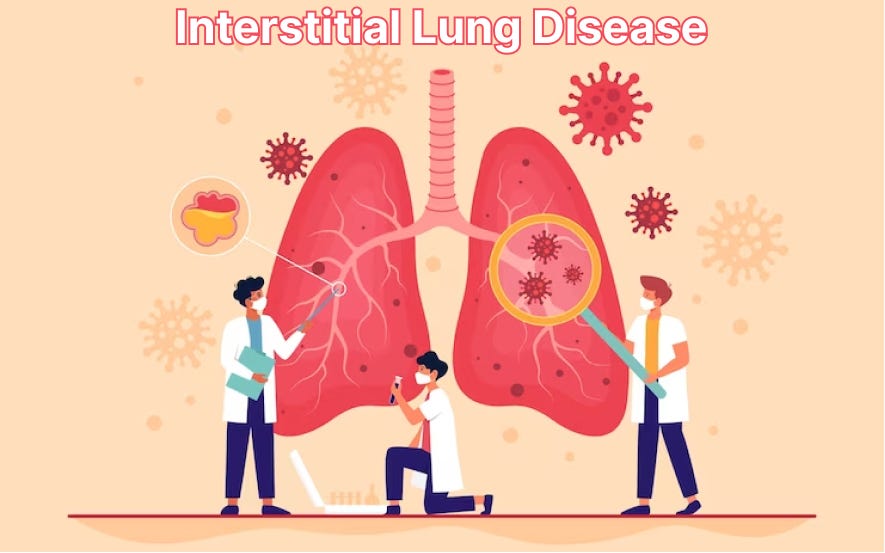 Everything to Know About Interstitial Lung Disease by Drsheetusingh