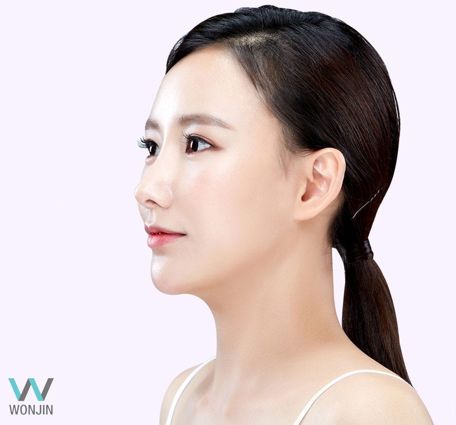 Wide Nose Bridge Complex? Korea Rhinoplasty GO! by Park Medium