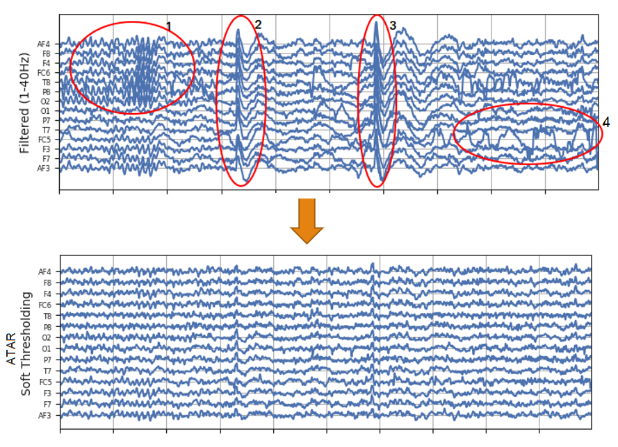 Artifacts in EEG and how to remove them ATAR, ICA by Nìkεsh βajaj Medium