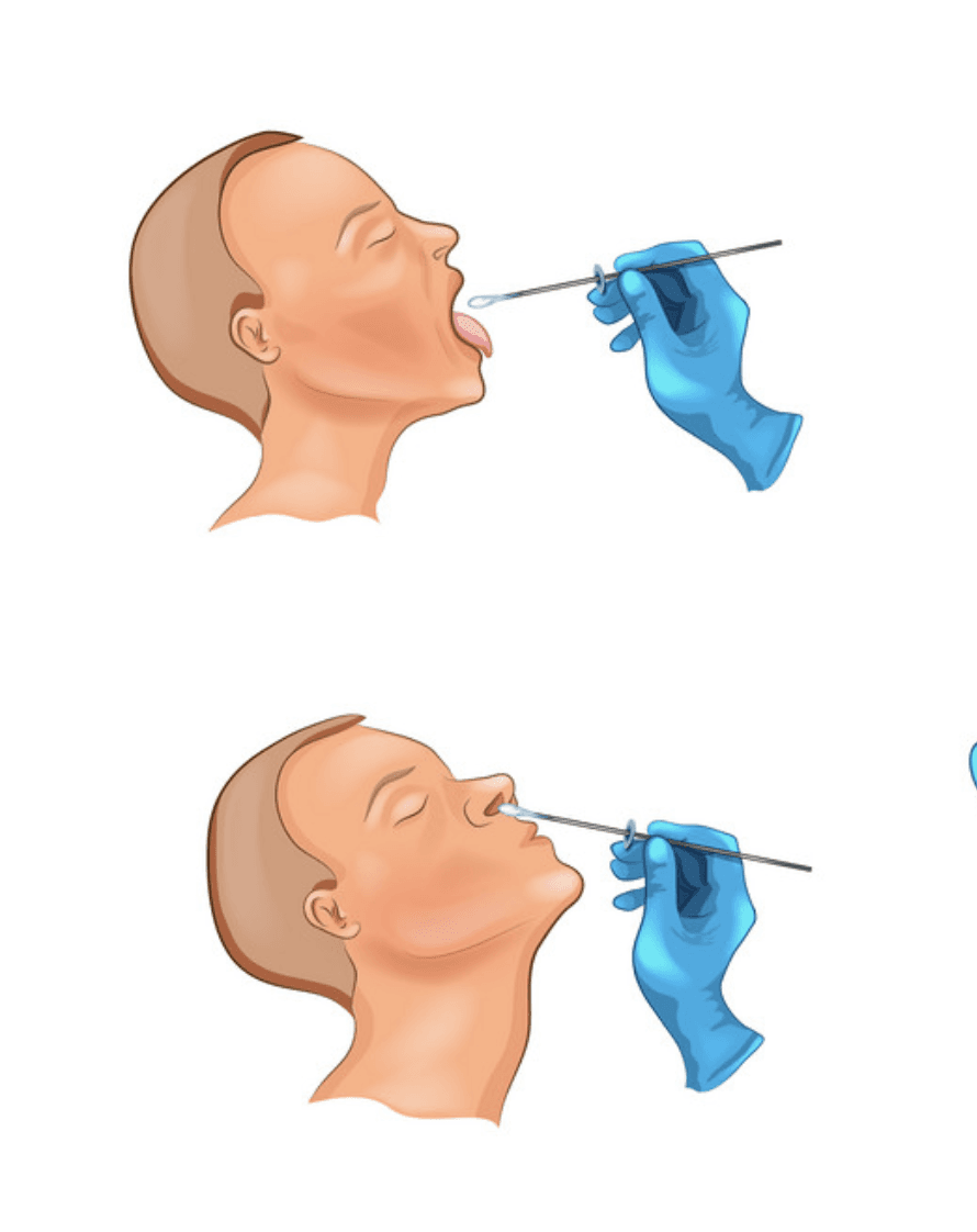 взятие мазка на ковид из носа. забор материала из носоглотки. взятие мазка из зева и носа алгоритм. техника взятия мазка из носа. тампон для взятия мазка из носоглотки.