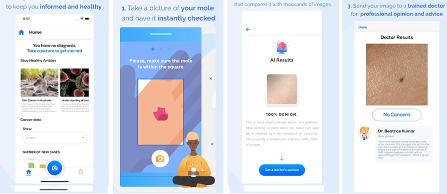 Scanoma Check Moles And Detect Skin Cancer Risk By Ashraful Alam 