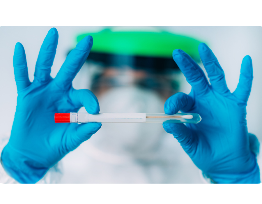 HIV Testing 4th Generation. HIV testing has been a vital tool in… by