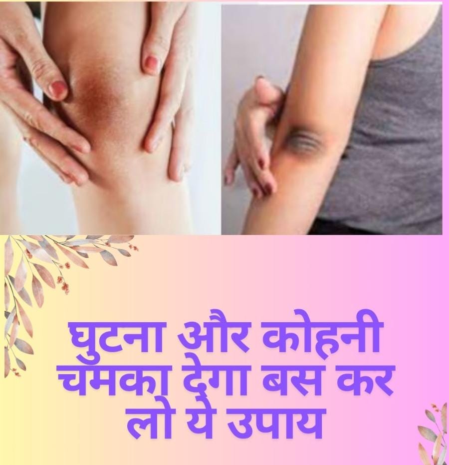 घुटना और कोहनी चमका देगा बस कर लो यह उपाय