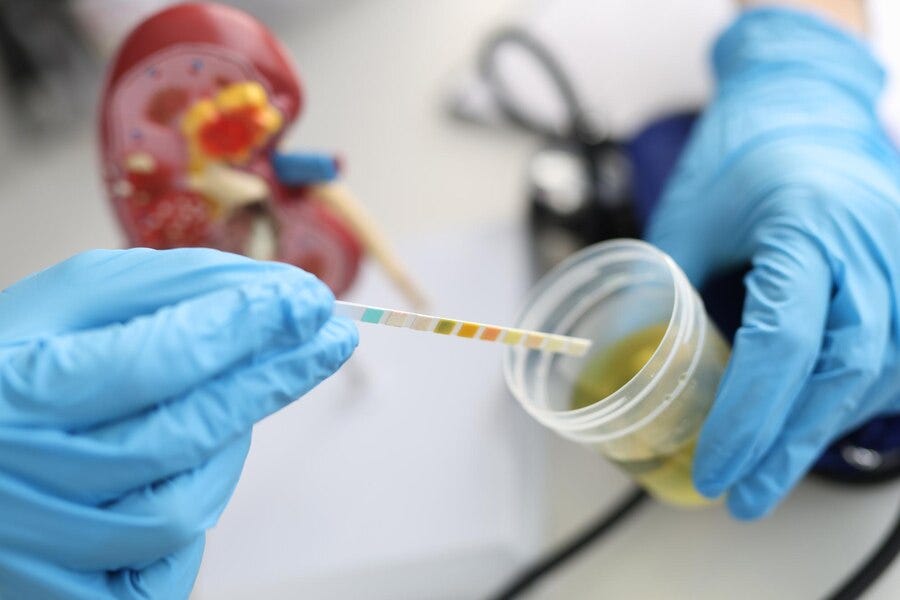 Why Do You Need Urine Culture And Susceptibility Testing? by SRL