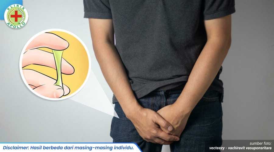 Pengobatan Penis Keluar Cairan Hijau Sesuai Penyebab