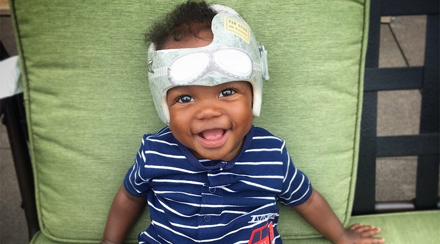 How long does a child typically need to wear a helmet during