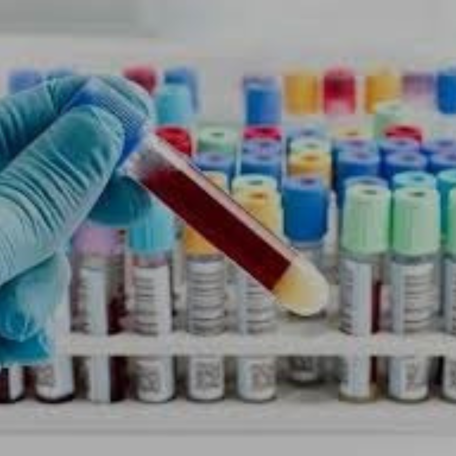 Blood Test Near Noida UniQ Pathlab by Uniq Pathlab Dec, 2023 Medium