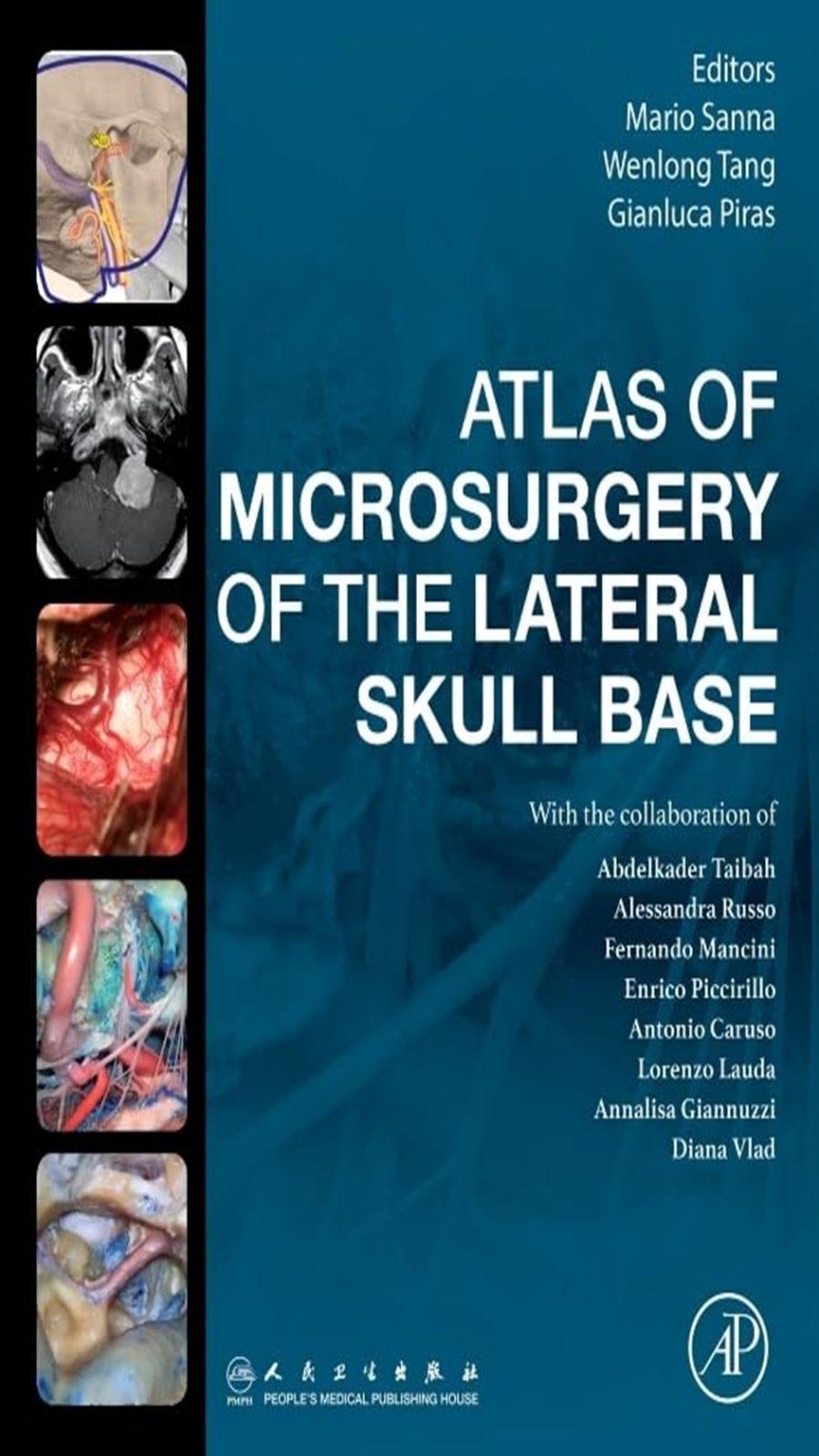🧠🔬 Atlas of Microsurgery of the Lateral Skull Base — 1st Edition
by Mario Sanna
