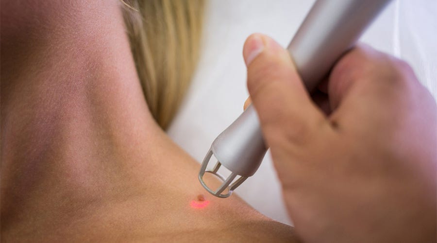 SKIN TAG REMOVAL A perfect guide to understanding the whole by