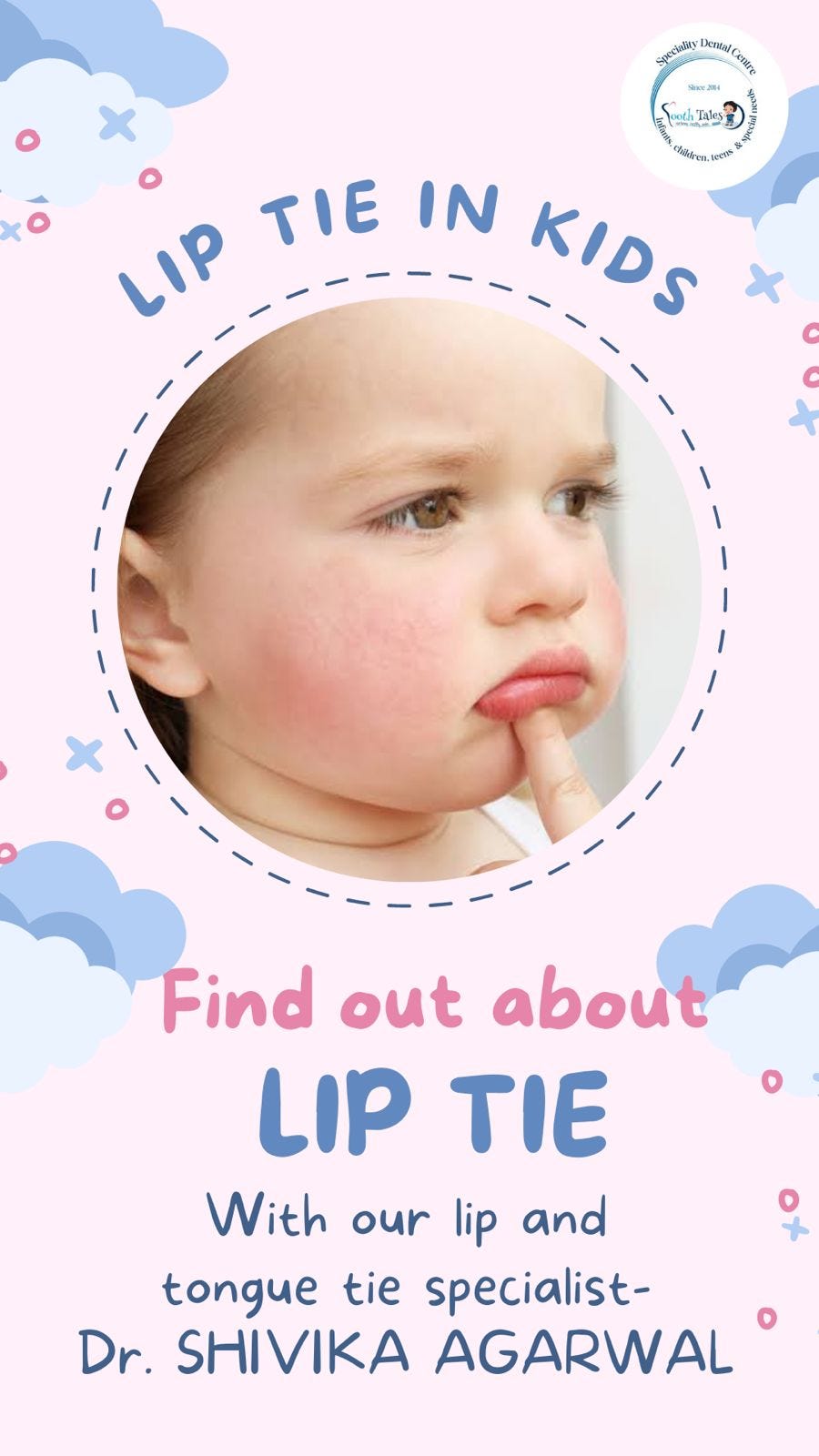 Lip tie Clinictoothtales Medium