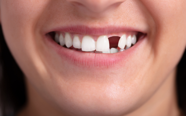 The Benefits of Cosmetic Dentistry: Why You Should Consider it