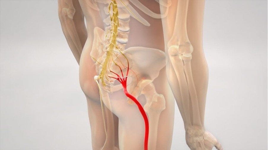 Get Sciatica Pain Relief by Adopting Effective and Natural Methods