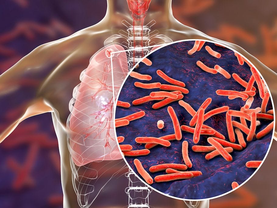 Mutation of rpoB gene in Tuberculosis
