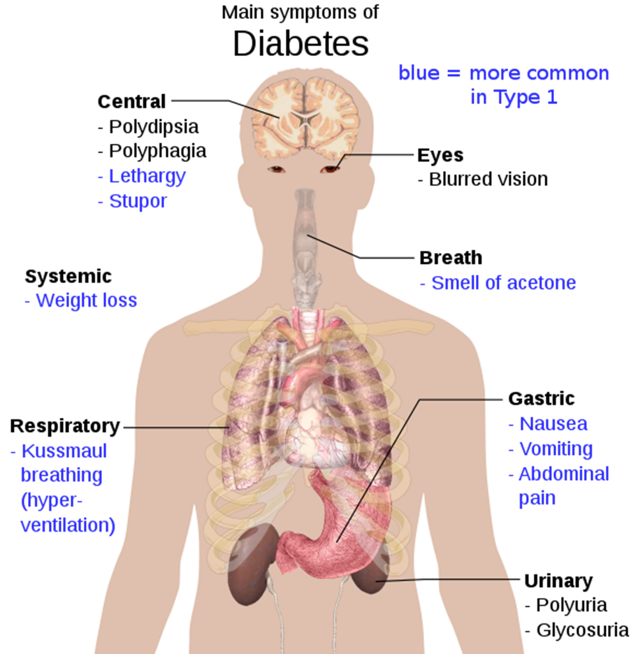 focus-on-health-diabetes-is-a-really-loathsome-jaw-dropping-disease