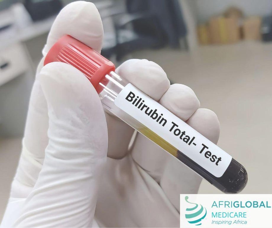Bilirubin Test Afriglobal Medium