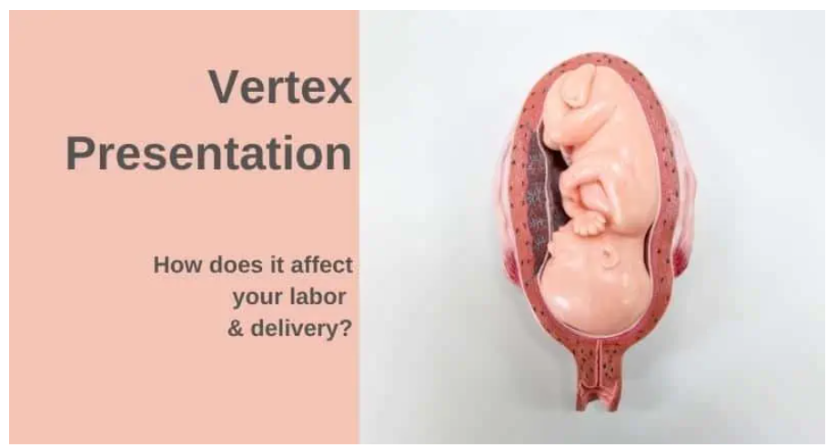 fetal presentation vertex means