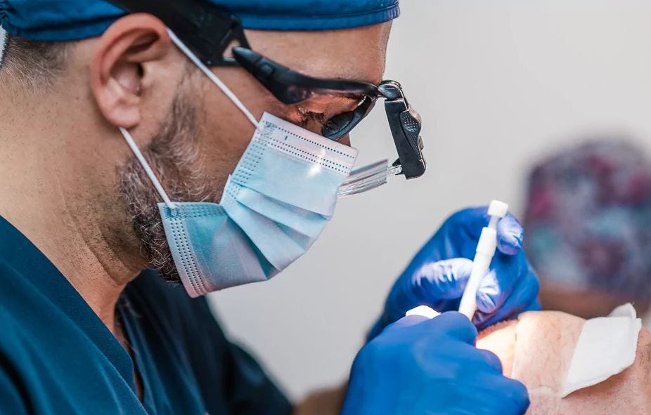 Are you a good candidate for hair transplant surgery? - Dr Bonaros