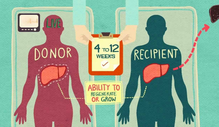 ORGAN TRANSPLANT