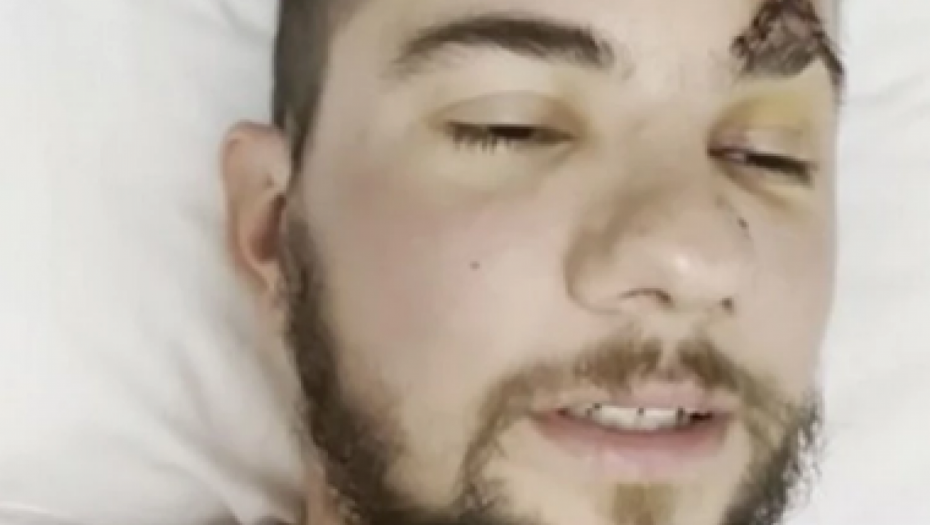 Leo Pavlačić pao sa 20 metara visine, hitno prevezen u bolnicu