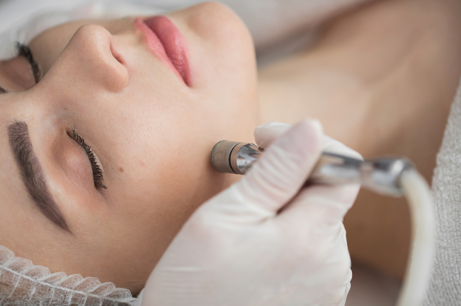 Unveiling the Glow My Transformative Experience with Dermabrasion