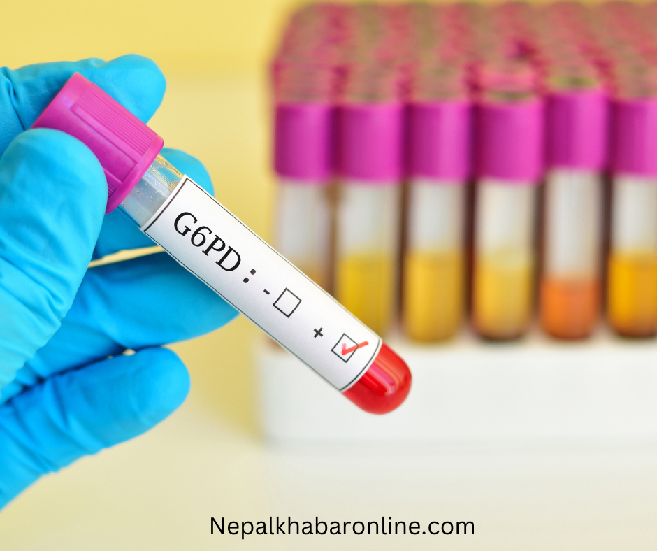 G6PD Test & 8Symptoms of G6PD Deficiency
