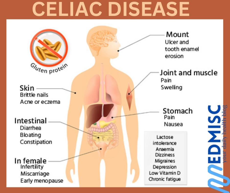 Diagnose gluten intolerance symptoms