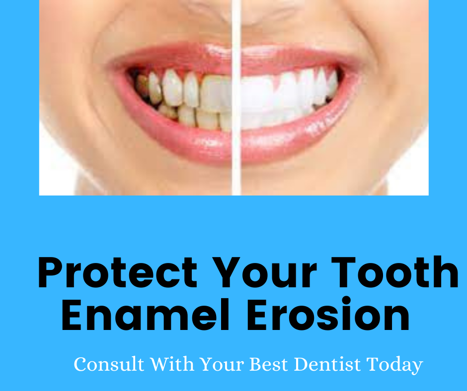 Best Protect Your Tooth Enamel Erosion With A Dentist Consultation by