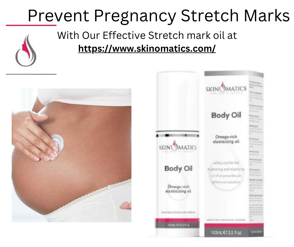 Elegance in Every Phase How to Prevent Pregnancy Stretch Marks with
