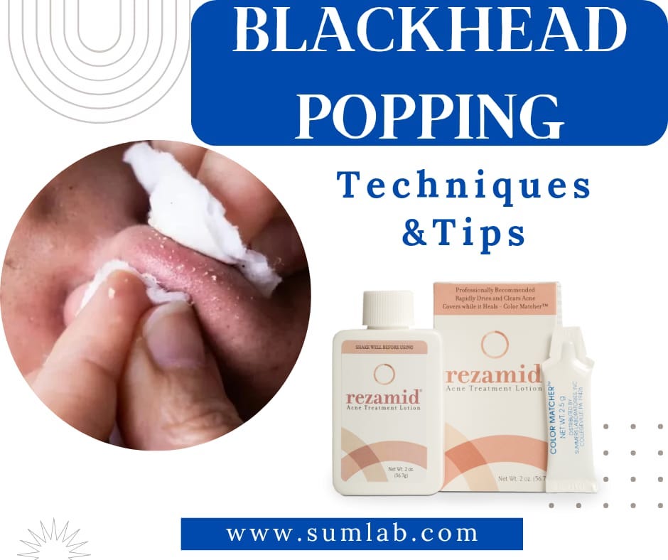 What to do when a blackhead pops? Summerslaboratories Medium