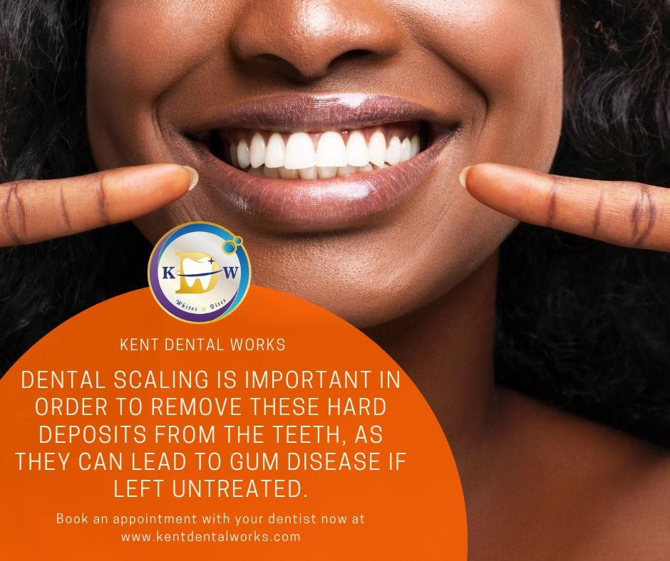 Dental Scaling and Polishing (Teeth Cleaning) in Singapore — Kent