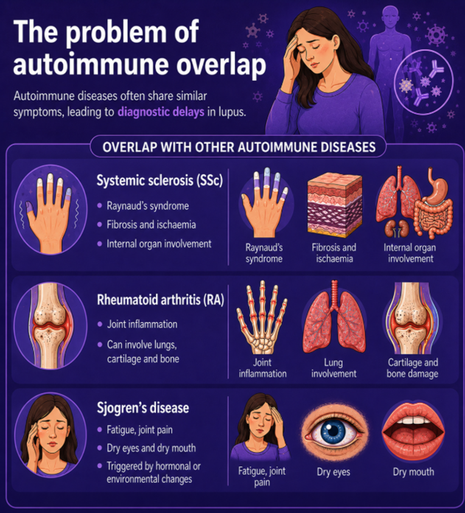 Diagnostic delays in Systemic Lupus Erythematosus and the problem of autoimmune overlap