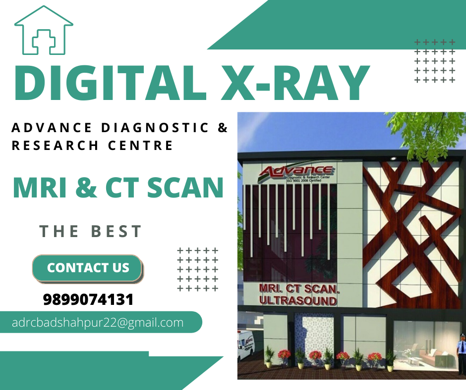 Digital xray cost in Manesar Gurgaon by Advance Diagnostic