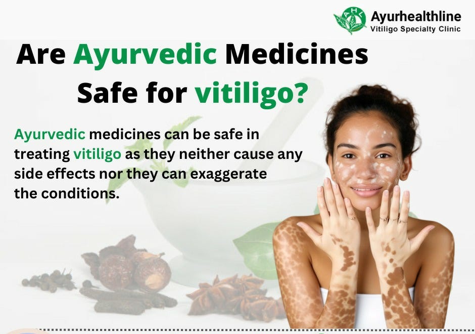 Exploring Effective Vitiligo Treatment in India Ayurveda’s Healing