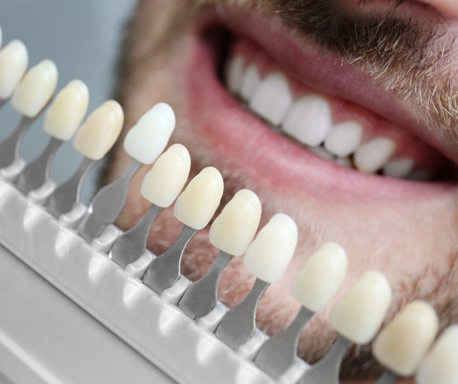 How To Choose The Right Veneers For You? by Pure smile center Cabo