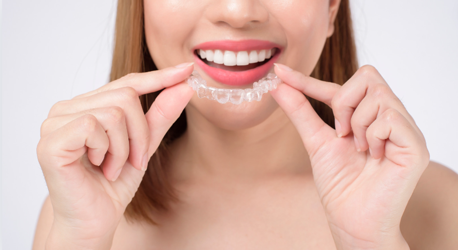 The Secret Behind The Speed Why Invisalign Treatment Is Faster