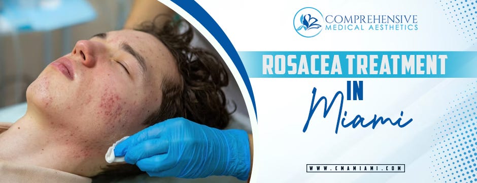 Rosacea Treatment in Miami: Unveiling the Elegance of Radiant Skin at ...