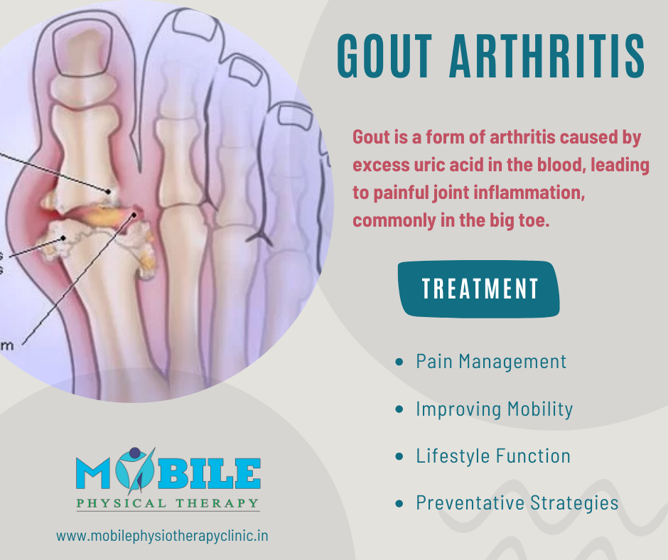 Understanding Gout: Causes, Symptoms, and Treatment | by Dhara Shiroya ...