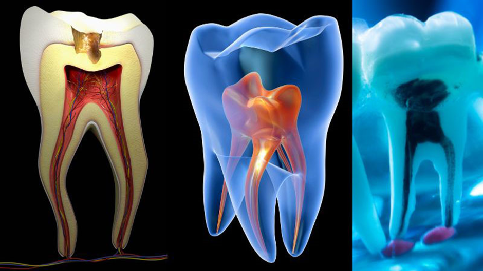 Exploring Pulpotomy A ToothSaving Procedure by Gnancy Jebadurai