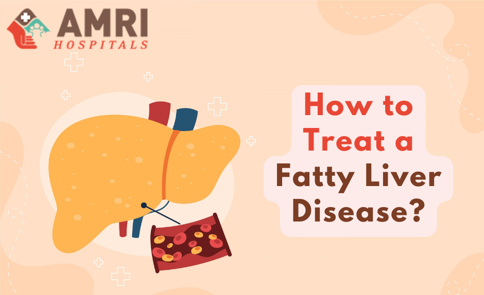 How to Treat a Fatty Liver Disease? Medium
