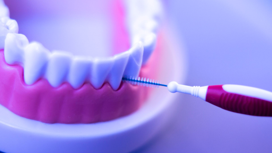 How Often Should You Get Your Teeth Cleaned? by Isakow Dental Medium