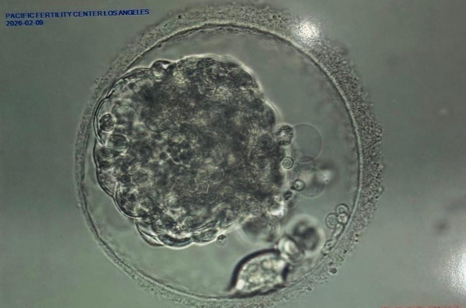 Diary of a Second Embryo Transfer