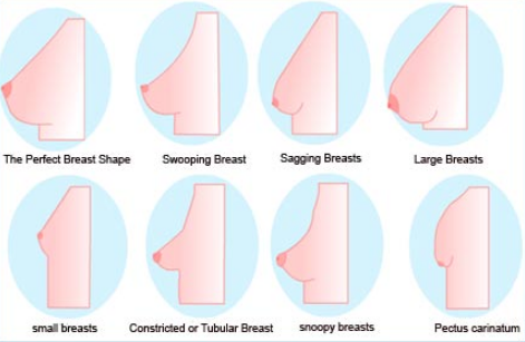 Breasts come in all different shapes and sizes 🩷