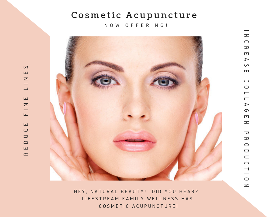 Cosmetic Acupuncture in Albuquerque, NM Acuquerque Medium