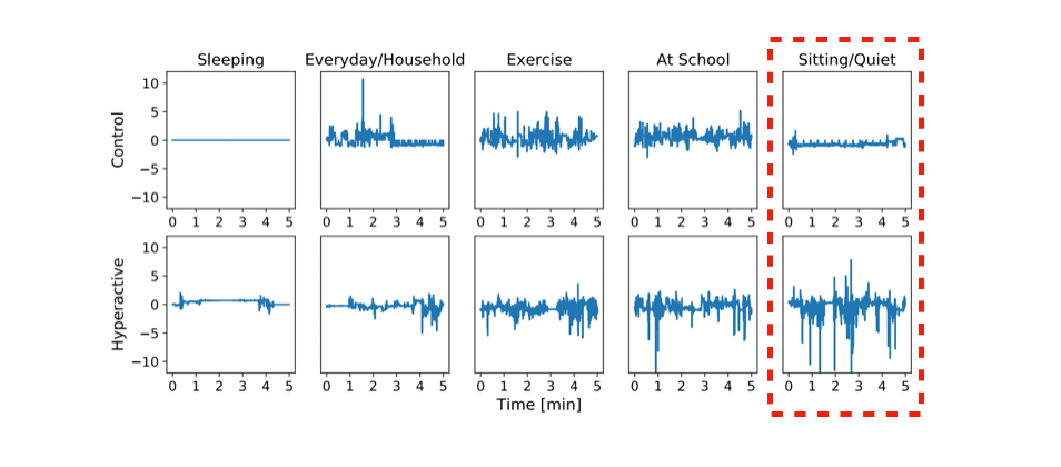 ADHD (Hyperactivity) Detection in Children by Smartwatch