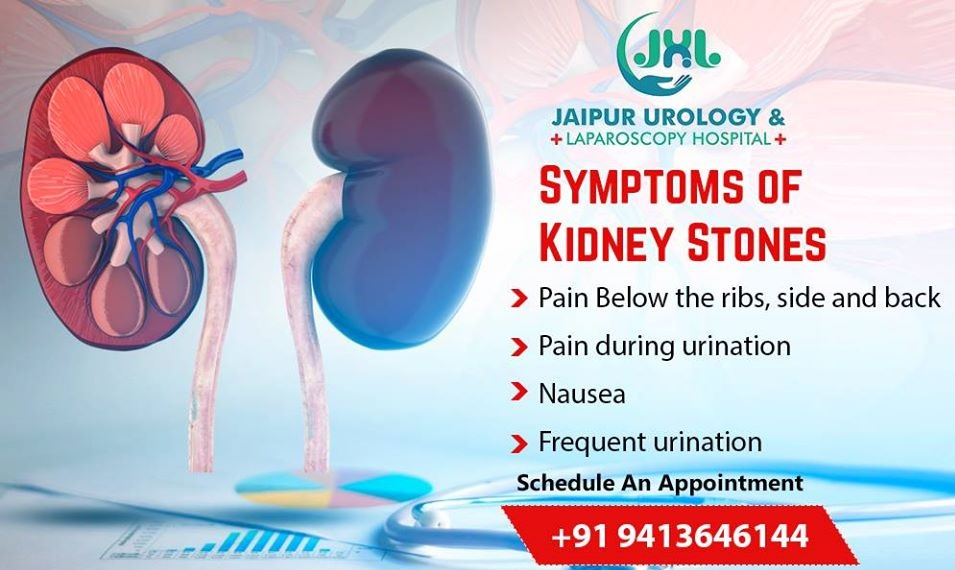 Major Procedures Adopted by Expert Urologists For Kidney Stone